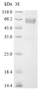 Recombinant Human Sclerostin domain-containing protein 1 (SOSTDC1)