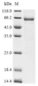 Recombinant Human metapneumovirus Matrix protein (M)