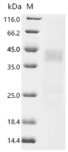 Recombinant Rat Asialoglycoprotein receptor 1 (Asgr1), partial