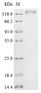 Recombinant Human Disks large homolog 4 (DLG4)