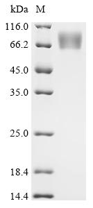 Recombinant Human cytomegalovirus Protein UL16 (UL16), partial