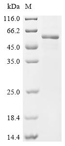 Recombinant Human E3 ubiquitin-protein ligase RNF128 (RNF128), partial