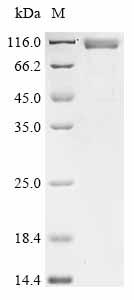 Recombinant Mopeia virus Pre-glycoprotein polyprotein GP complex (GPC), partial