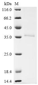 Recombinant Human Retinaldehyde-binding protein 1 (RLBP1)