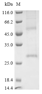 Recombinant Human Claudin-18.2(CLDN18.2)-Detergent (Active)