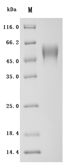 Recombinant Human Cytokine receptor common subunit gamma(IL2RG), partial (Active)