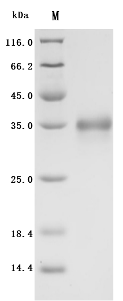 Recombinant Human Folate receptor alpha(FOLR1), partial (Active)