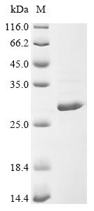 Recombinant Lupinus angustifolius Conglutin beta, partial