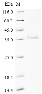 Recombinant Human Ras-related protein Rab-33A (RAB33A)