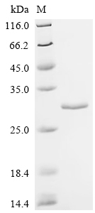 Recombinant Human Ras-related protein Rab-6B (RAB6B)
