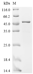 Recombinant Human Cyclin-dependent kinase inhibitor 1 (CDKN1A)