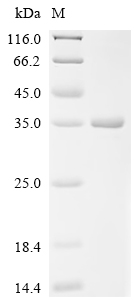 Recombinant Mouse CD209 antigen-like protein B (Cd209b), partial