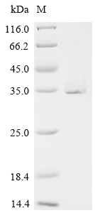 Recombinant Human Ras-related protein Rab-6A (RAB6A)