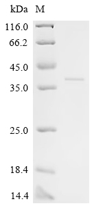 Recombinant Human FERM, ARHGEF and pleckstrin domain-containing protein 2 (FARP2), partial