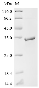 Recombinant Human Ras-related protein Rab-6B (RAB6B)