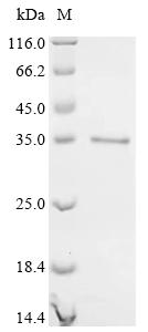 Recombinant Lymphocytic choriomeningitis virus Pre-glycoprotein polyprotein GP complex (GPC), Partial