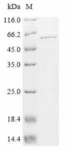 Recombinant Human Serine/threonine-protein phosphatase 2A regulatory subunit B' subunit gamma (PPP2R3C)