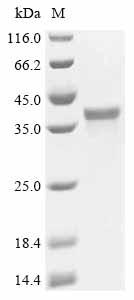 Recombinant Human Spastin (SPAST), partial