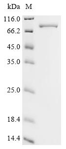 Recombinant Human Tyrosine-protein kinase ZAP-70 (ZAP70)