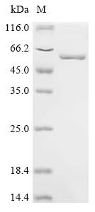 Recombinant Human Gasdermin-A (GSDMA)