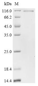 Recombinant Human Fragile X mental retardation syndrome-related protein 1 (FXR1)