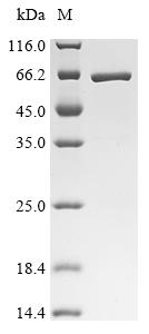 Recombinant Human Interferon-induced protein with tetratricopeptide repeats 1 (IFIT1)