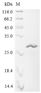 Recombinant Japanese encephalitis virus Envelope protein (E), Partial