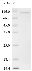 Recombinant Human Cold shock domain-containing protein E1 (CSDE1)