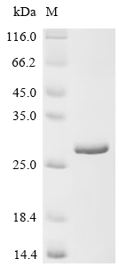 Recombinant Human Ras-related C3 botulinum toxin substrate 1 (RAC1)