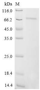 Recombinant Influenza B virus Hemagglutinin (HA), partial