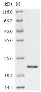 Recombinant Influenza A virus Matrix protein 2 (M2), partial