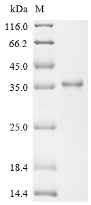 Recombinant Mouse Golgin subfamily A member 2 (Golga2), partial