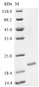 Recombinant Bovine PDGFB protein (PDGFB), Partial