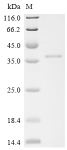 Recombinant Human Deoxyribonuclease-1-like 2 (DNASE1L2)