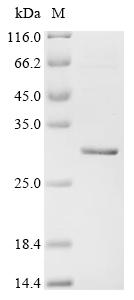 Recombinant Epstein-Barr virus Glycoprotein 42 (BZLF2), partial