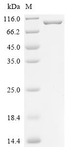 Recombinant Human Poly [ADP-ribose] polymerase tankyrase-1 (TNKS), Partial