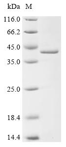 Recombinant Human Fatty acid-binding protein, liver (FABP1)