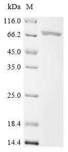 Recombinant Human parainfluenza 2 virus Nucleoprotein(N)