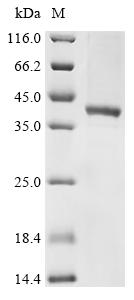 Recombinant Human Adenylate cyclase type 3 (ADCY3) , Partial