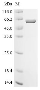 Recombinant Human Apoptosis-associated speck-like protein containing a CARD (PYCARD), partial, Biotinylated