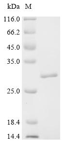 Recombinant Human Protein FAM167B (FAM167B)