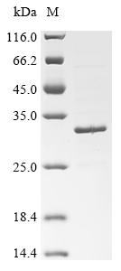 Recombinant Severe acute respiratory syndrome coronavirus 2 Spike glycoprotein (S), partial (L452R,T478K)