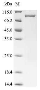Recombinant Human Peroxisome prolifeRator-activated receptor gamma (PPARG)
