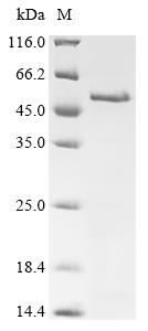Recombinant Human Melanoma-associated antigen 4 (MAGEA4)
