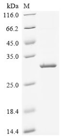 Recombinant Human Podocin (NPHS2), Partial