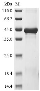 Recombinant Human Nucleoporin NUP35 (NUP35)
