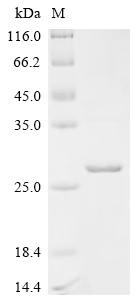 Recombinant Human Serine/threonine-protein kinase TBK1 (TBK1), partial