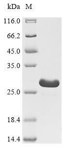 Recombinant African swine fever virus Inner membrane protein p54 (p54), partial