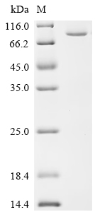 Recombinant Human Poly [ADP-ribose] polymerase tankyrase-2 (TNKS2), partial