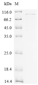 Recombinant Human Alpha-L-iduronidase (IDUA)